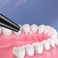 Limpador de dentes elétricos ultrassônicos portátil da casa